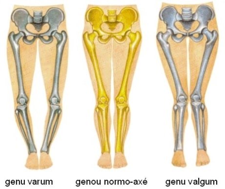genus rodillas